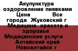 Акупунктура, оздоровление пиявками › Цена ­ 3 000 - Все города, Жуковский г. Медицина, красота и здоровье » Медицинские услуги   . Алтайский край,Новоалтайск г.